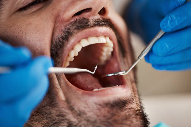 Best Pediatric Emergency Dentist in South Beach, FL